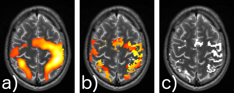 Signal detection in fMRI